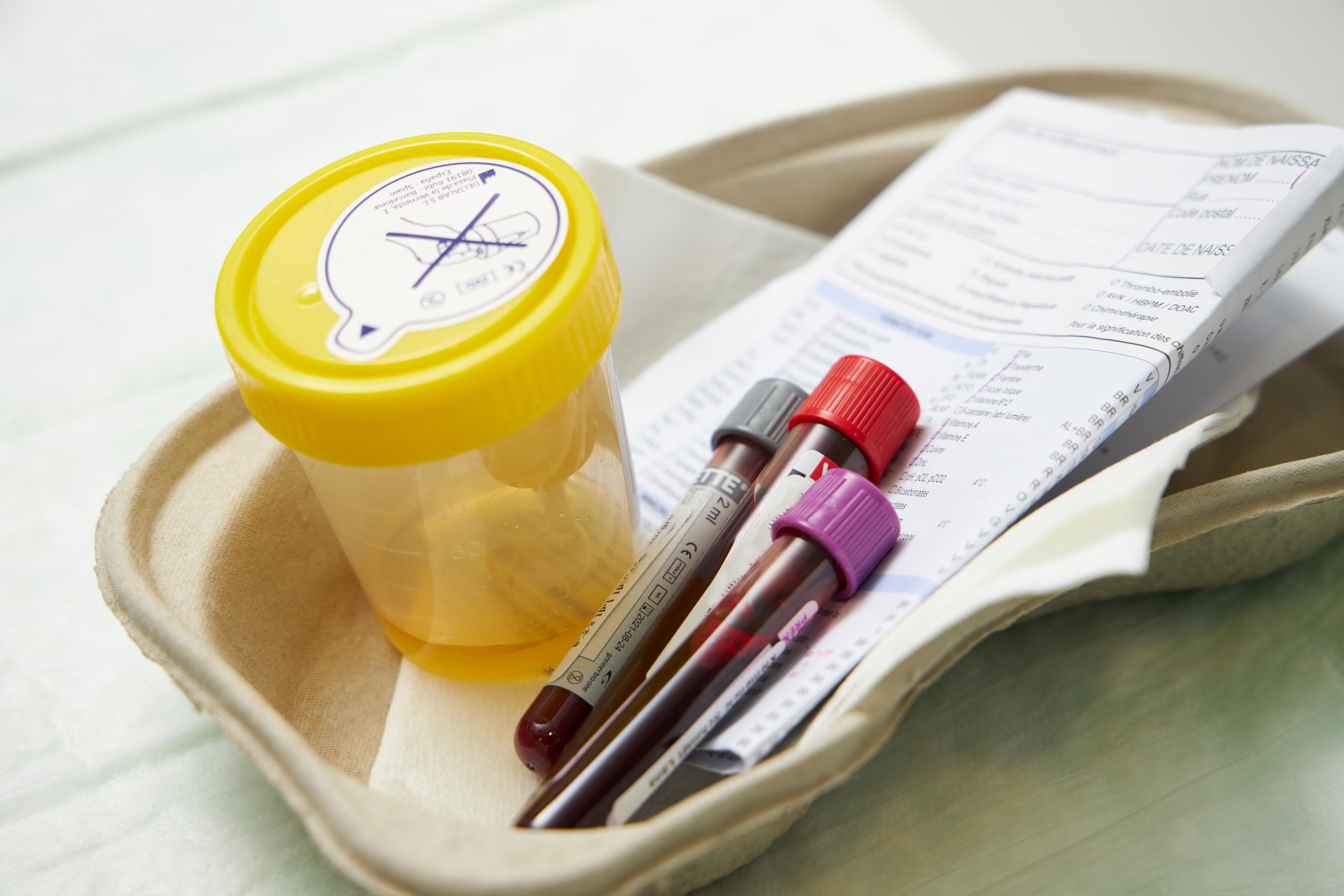 Nieuwe zakjes voor staaltransport