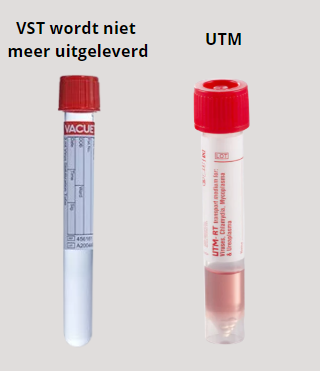 VST wordt vervangen door UTM
